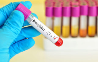Symptoms of Hemophilia You Shouldn't Ignore